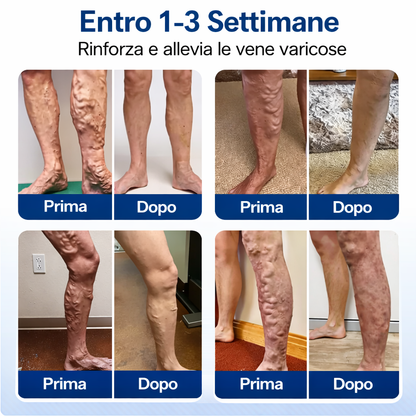 Gambe perfette Thera™ Addio a Gambe Pesanti e Vene Visibili
