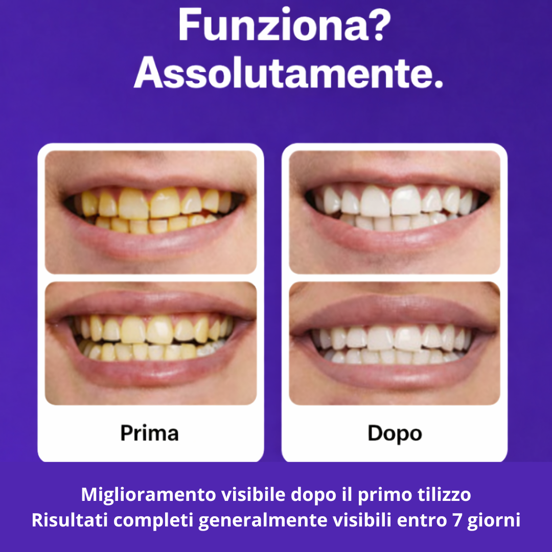 WhiteSmile Pro Strips sbiancanti istantanee viola per i denti