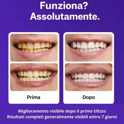 WhiteSmile Pro Strips sbiancanti istantanee viola per i denti