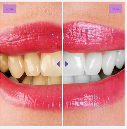 WhiteSmile Pro Strips sbiancanti istantanee viola per i denti