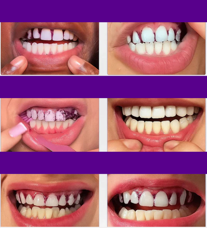 WhiteSmile Pro Strips sbiancanti istantanee viola per i denti